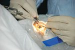 operation eye